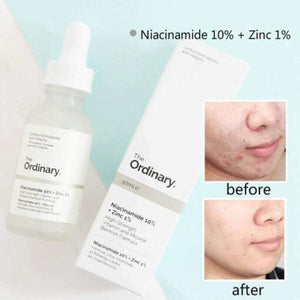 ORDINARY NIACINAMIDE 10% + ZINC 1% – 30ML